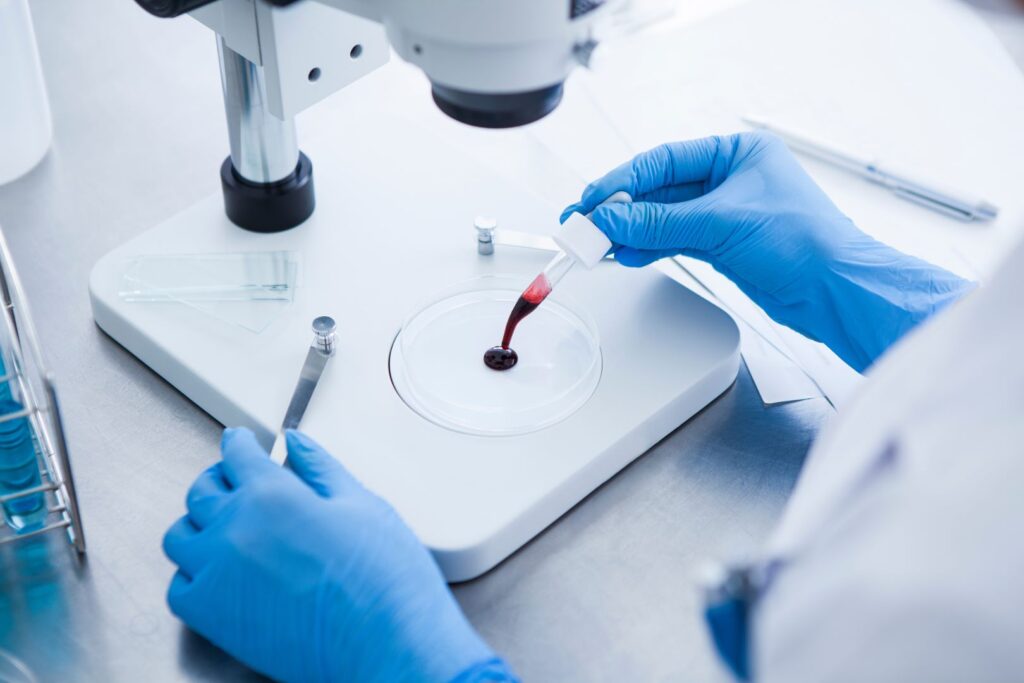 Měření krevní srážlivosti | Ordinace Viva s.r.o. a Havlíčková Renata MUDr. s.r.o.